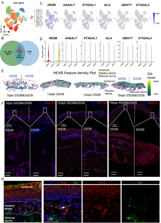 图2. HEXB在深二度与浅二度烧伤真皮组织中呈现差异表达且具有时间动态变化